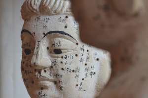 acupuncture médecine chinoise traditionnelle